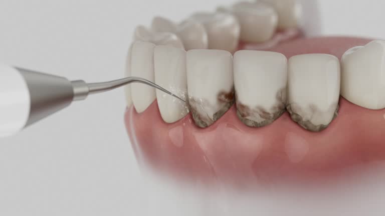 Reliable Dental Implants contractor in Winston, OR by Smile Center Dentistry